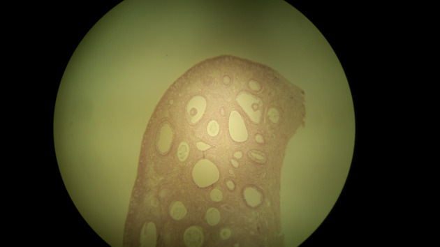 Ovary Graafian Follicle Slides - Ovary Graafian Follicle 001 100X